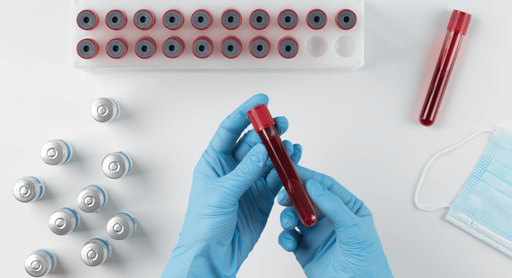 Annual blood tests and preventive health checkup