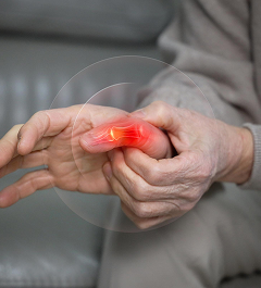 Arthritis Profile package